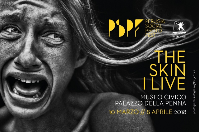 Perugia Social Photo Fest - THE SKINE I LIVE, Museo Civico Palazzo della Penna