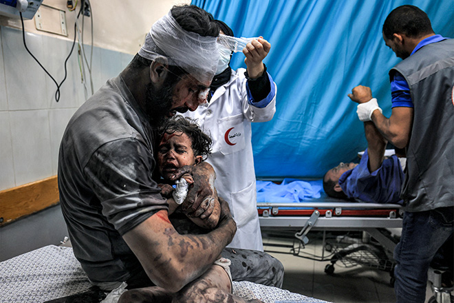 Mahmud Hams (Palestinian) / Courtesy All About Photo - GAZA WAR - Father's hug, Particular Merit Award Gallery, All About Photo Awards 2024 - The Mind’s Eye.
An injured man holds another injured child, both survivors of Israeli bombardment, while a nurse bandages his head at a trauma ward at Nasser hospital in Khan Yunis in the southern Gaza Strip on October 24, 2023 amid the ongoing battles between Israel and the Palestinian group Hamas. Thousands of civilians, both Palestinians and Israelis, have died since October 7, 2023, after Palestinian Hamas militants based in the Gaza Strip entered southern Israel in an unprecedented attack triggering a war declared by Israel on Hamas with retaliatory bombings on Gaza. (Photo by Mahmud HAMS / AFP)